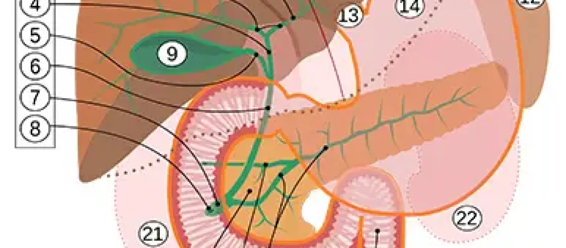 endo gi medical center Endoscopic-treatment-of-chronic-pancreatitis